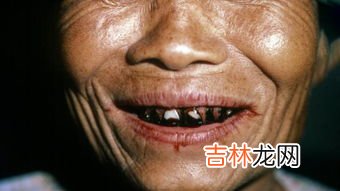 槟榔里面的黑油是什么,槟榔里面的那一层黑的是什么东西，可以吃吗？