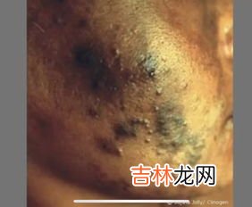 特丁基对苯二酚对人身体有伤害吗,特丁基对苯二酚为什么不禁止