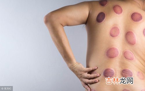 拔罐拔出水泡是怎么回事,拔罐拔出水泡来是怎么回事
