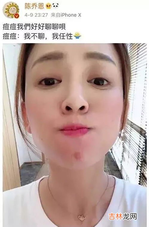吃干脆面会长痘痘吗,为什么一吃方便面或者泡面,脸上就容易长痘痘?