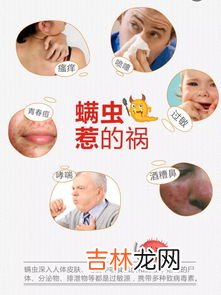 床上有螨虫怎么处理,床上螨虫怎么处理