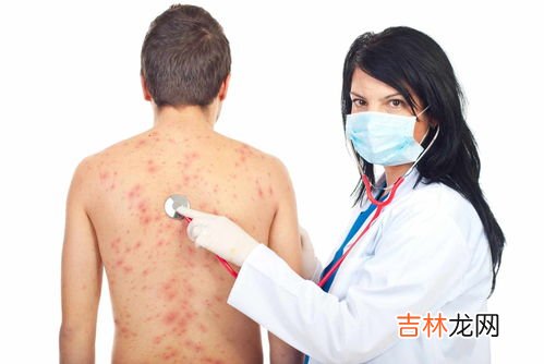 床上有螨虫怎么处理,床上螨虫怎么处理