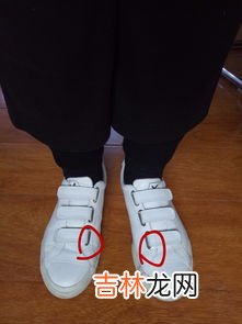 白鞋的皮掉了怎么办,运动鞋上面的白皮掉了怎么办?