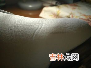 白鞋的皮掉了怎麽辦,運動鞋上面的白皮掉了怎麽辦？