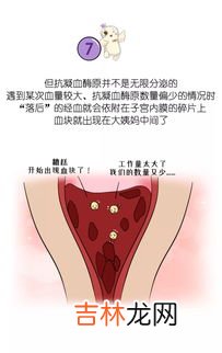 姨妈为什么会有血块,月经有血块怎么回事