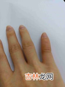 剥大蒜后手指疼怎么办,弄完大蒜手很辣怎么办