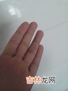 剥大蒜后手指疼怎么办,弄完大蒜手很辣怎么办