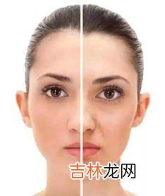 点痣后多久可以化妆,激光点痣多久可以化妆?