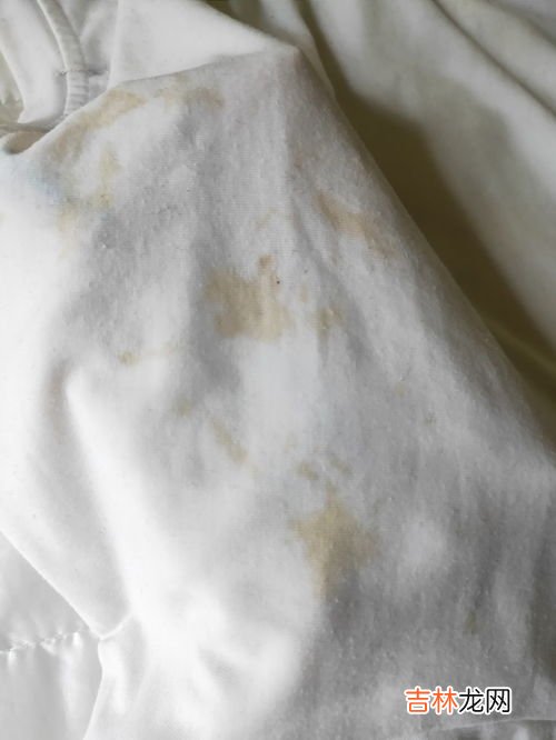 白衣服上的污渍怎么洗掉小妙招,白衣服上污渍怎么处理