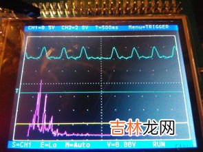 人的心率与寿命成正比,老年人心率正常值是多少