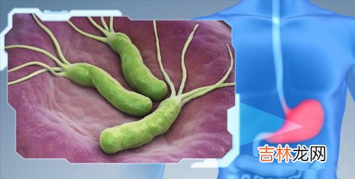 蠓虫的克星,如何祛除花盆中的小蠓虫?