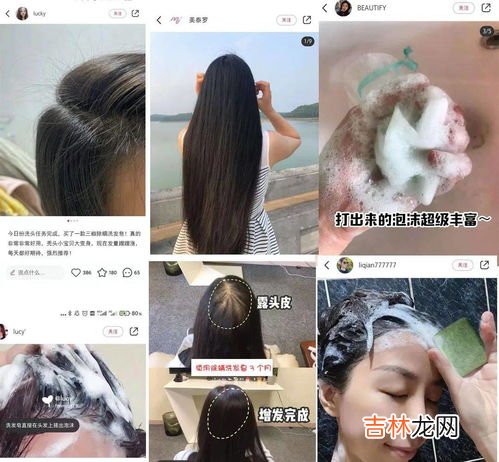 洗完头头皮痒,用完洗发水头皮痒怎么回事