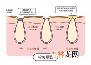 如何清洁毛孔的脏东西,毛孔里的垃圾怎么清理出来