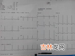 心率简写,频率是怎么计算的？