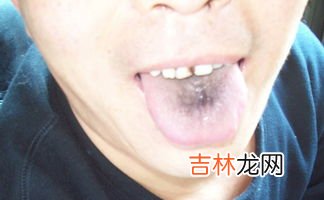 吃石榴舌头发黑是怎么回事,为什么吃了石榴以后舌头牙齿嘴巴