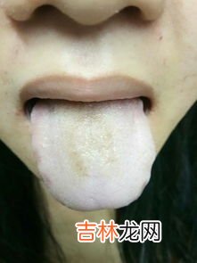 吃石榴舌头发黑是怎么回事,为什么吃了石榴以后舌头牙齿嘴巴