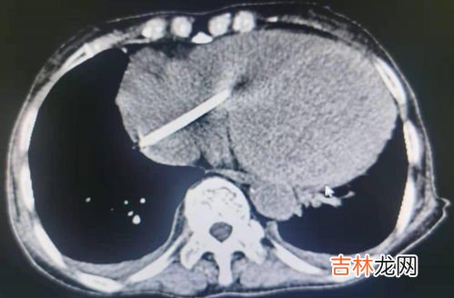 鱼有没有心脏,鱼有心脏吗