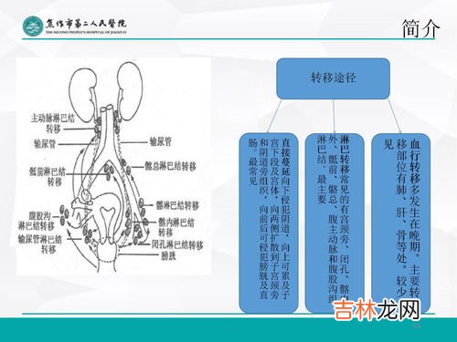 约束带使用的注意事项,约束法注意事项