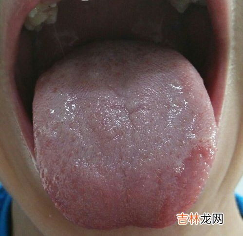 为什么舌头发白,舌苔发白是什么原因