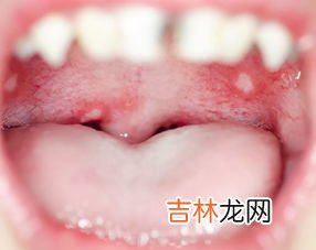 为什么舌头发白,舌苔发白是什么原因