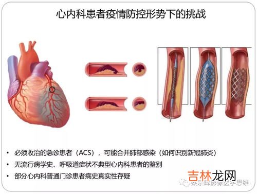 怎么辨别新型冠状病毒,如何判断是否感染新型冠状肺炎病毒