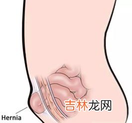 唱歌时小腹是缩还是鼓,歌唱家用腹式呼吸唱歌吐字时,小腹应: 鼓起来还是凹下去?