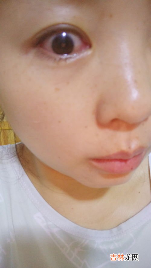 眼睛为什么痒,眼睛痒是什么原因引起的?