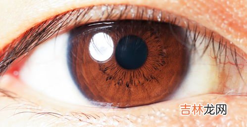 眼睛为什么痒,眼睛痒是什么原因引起的?