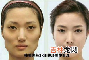 怎样判断自己颧骨高,怎样判断自己颧骨高