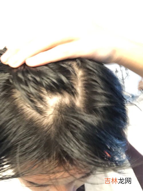 怎么让头发变硬,怎么让头发变硬