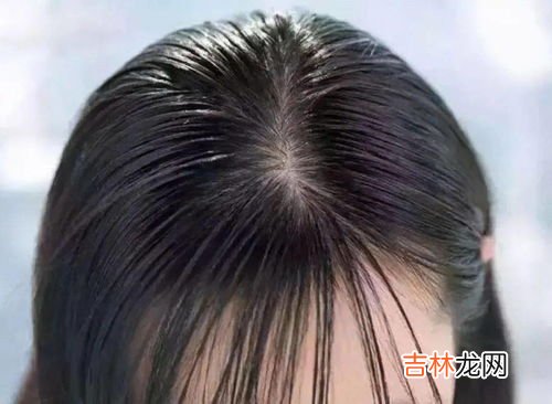 去除头发口香糖的妙招,口香糖粘在头发上怎么办