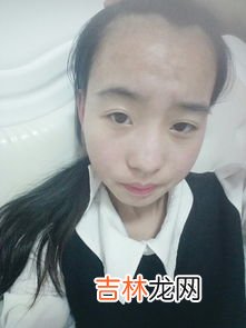 发际线能改变吗,发际线可以调整吗?