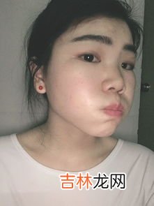 去除小胡子的小妙招,小胡子怎么去除