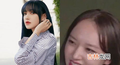 发际线变高的窍门,发际线过高的原因是什么?怎样才能解决发际线过高的问题?