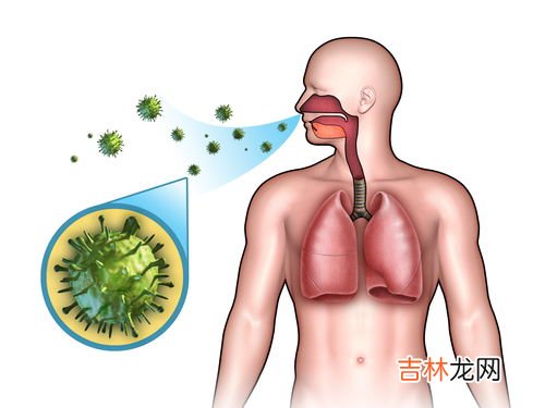 甲流会造成肺部后遗症吗,甲流愈后有后遗症吗