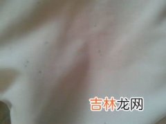 内裤上的黑点点怎么去除,内裤上有像发霉的小黑点，是怎么回事？