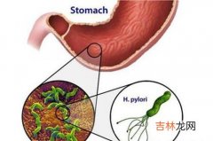 胃病会出现哪些症状,胃病有哪些症状表现？