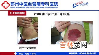 肝功能损害的症状表现是什么,人的肝脏不好的时候身体会有什么表现？