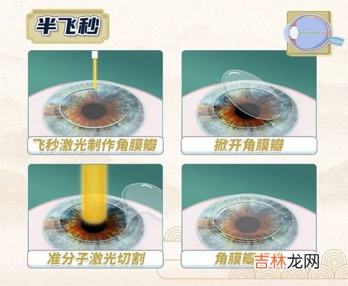 近视真的会遗传吗,近视真的会遗传给孩子么?