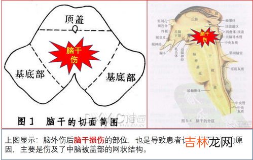 哪些疾病导致病重昏迷,太突然！江西2人昏迷，紧急送医，哪些疾病会突然发作？