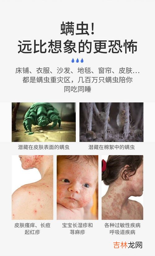 除螨包放在床上有毒吗,为什么除螨包放在床垫和床单之间，床垫却会湿了？