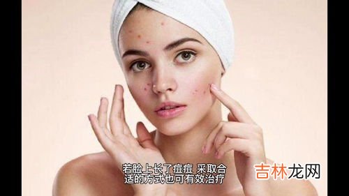 脸上长红痘怎么办,脸上有红痘痘该怎么办