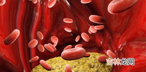 类风湿饮食要注意什么,类风湿的饮食要注意哪些