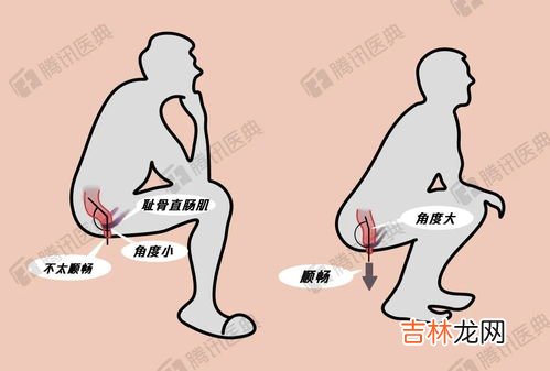 缓解便秘吃什么,便秘吃什么好?