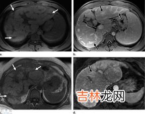 怎么辨别青少年潜在抑郁的求救信号,青少年抑郁前兆是什么症状