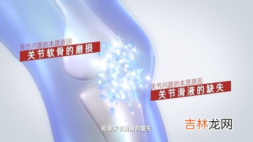 美国氨糖软骨素的种类,美国氨糖软骨素好不好