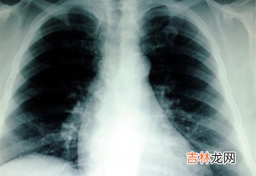 阳了怎么知道肺部是否感染,阳了要注意什么？