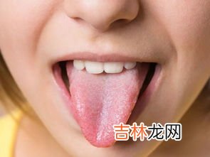 阳后舌头长满厚白舌苔是为什么,舌苔白厚什么原因