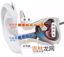 耳机对耳朵的伤害,长时间戴耳机对耳朵会有哪些伤害