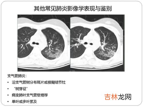 新冠对生理期有什么影响,女性来月经可不可以打新冠疫苗?